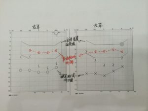 言语香蕉图